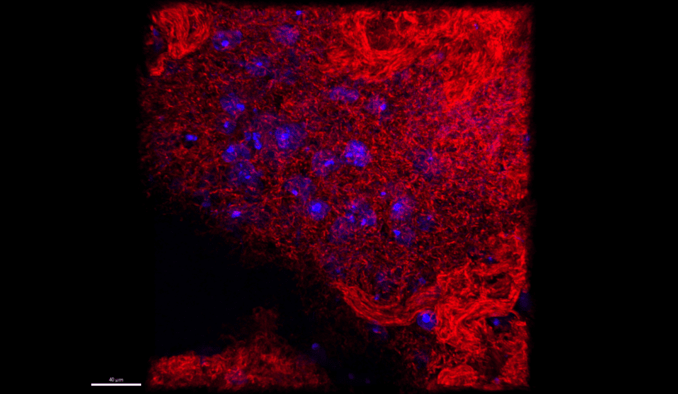 Biofilm Image Gallery - NBIC