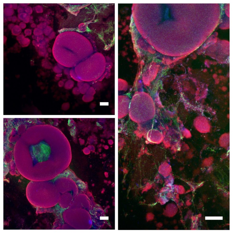 Biofilm Image Gallery - NBIC