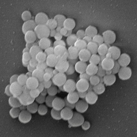 Research in Focus: Using Gelatin Nanoparticles To Find An Antibiotic Alternative